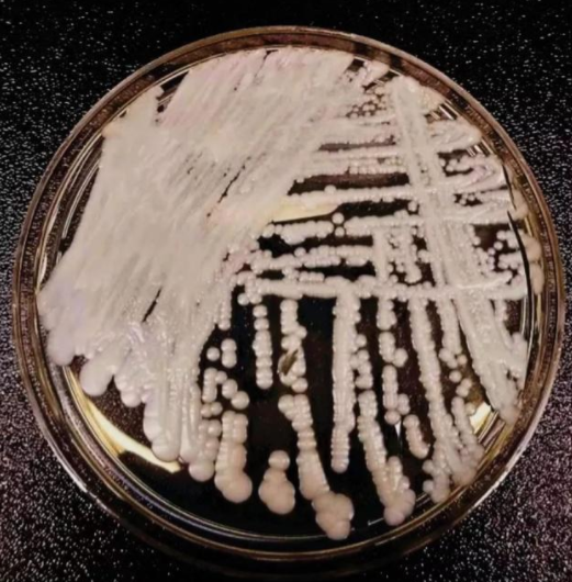 WHO 公布首份威胁健康的真菌清单